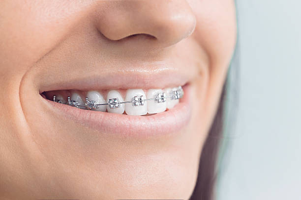 Best Dental Inlays and Onlays  in Mineola, TX